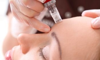 Microneedling mesotherapy